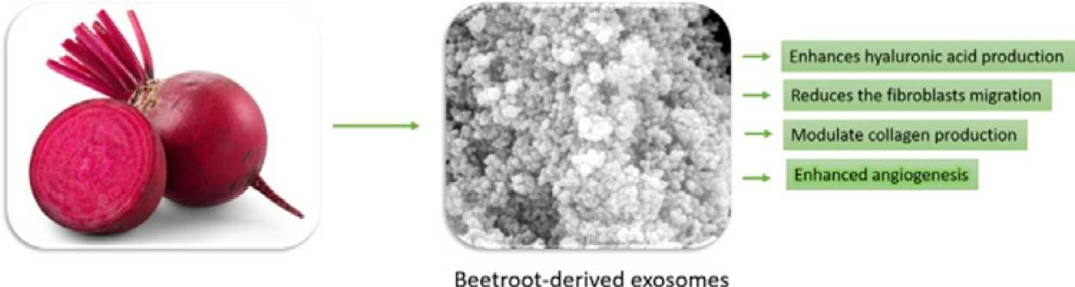 Beet juice contains beneficial exosome-like particles.